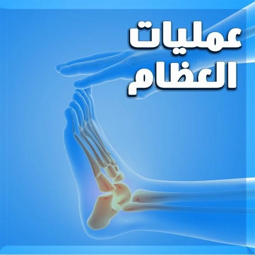 عمليات العظام