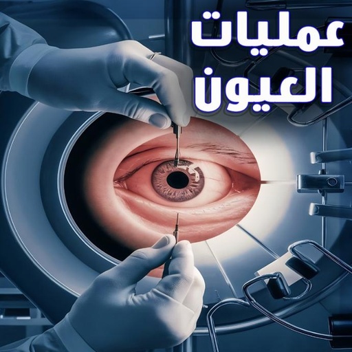 عيونهم .. آمل